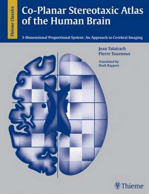 Co-Planar Stereotaxic Atlas of the Human Brain: 3-D Proportional System: An Approach to Cerebral Imaging de J. Talairach