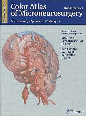 Color Atlas of Microneurosurgery, Volume 2: Cerebrovascular Lesions: Microanatomy, Approaches and Techniques de Robert F. Spetzler