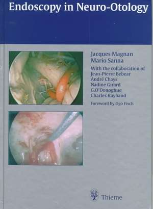 Endoscopy in Neuro-Otology de Jacques Magnan