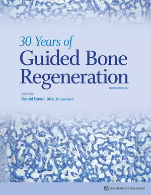 30 Years of Guided Bone Regeneration de Daniel Buser