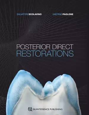 Posterior Direct Restorations de Salvatore Scolavino