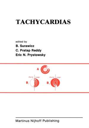 Tachycardias de Borys Surawicz