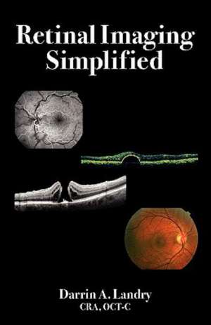 Retinal Imaging Simplified de Darrin A. Landry