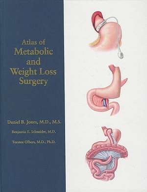 Atlas of Metabolic and Weight Loss Surgery de Daniel B. Janes