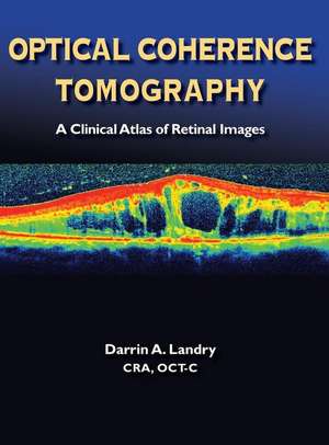 Optical Coherence Tomography de A. Landry Darrin