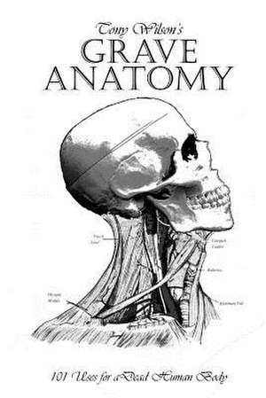 Grave Anatomy de Tony Wilson