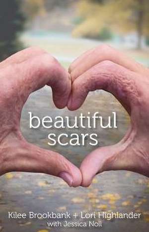 Beautiful Scars de Kilee Brookbank