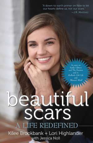 Beautiful Scars: A Life Redefined de Kilee Brookbank