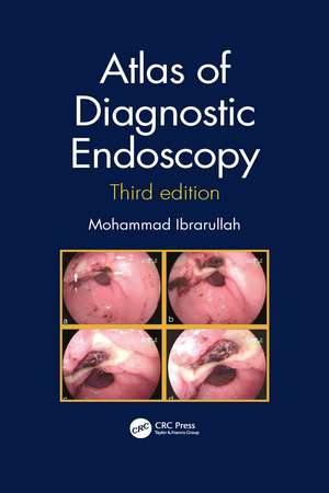 Atlas of Diagnostic Endoscopy, 3E de Mohammad Ibrarullah