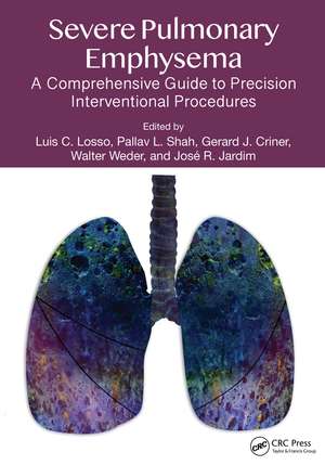 Severe Pulmonary Emphysema:: A Comprehensive Guide to Precision Interventional Procedures de Luis C. Losso