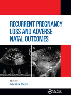 Recurrent Pregnancy Loss and Adverse Natal Outcomes de Minakshi Rohilla