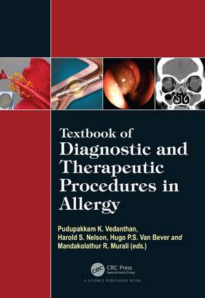 Textbook of Diagnostic and Therapeutic Procedures in Allergy de Pudupakkam K. Vedanthan