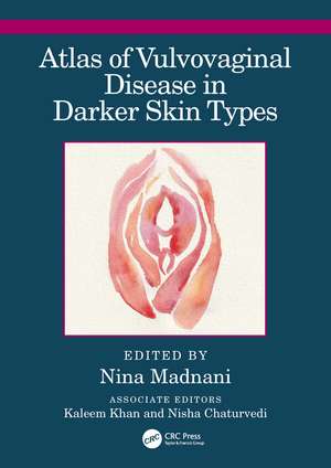 Atlas of Vulvovaginal Disease in Darker Skin Types de Nina Madnani