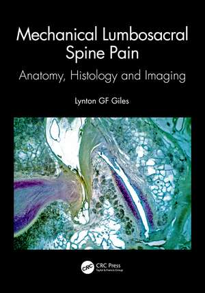 Mechanical Lumbosacral Spine Pain: Anatomy, Histology and Imaging de Lynton GF Giles