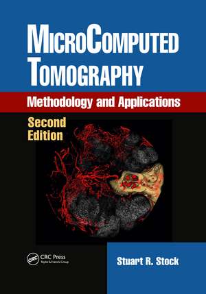 MicroComputed Tomography: Methodology and Applications, Second Edition de Stuart R. Stock