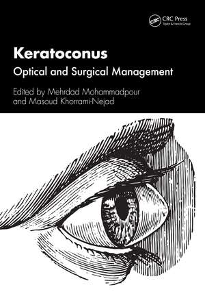 Keratoconus: Optical and Surgical Management de Mehrdad Mohammadpour