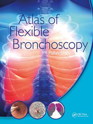 Atlas of Flexible Bronchoscopy de Pallav Shah