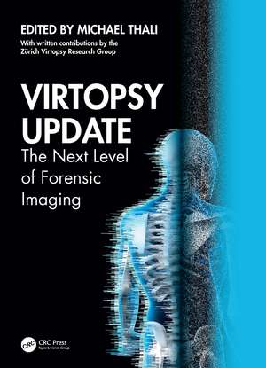 Virtopsy Update: The Next Level of Forensic Imaging de Michael Thali