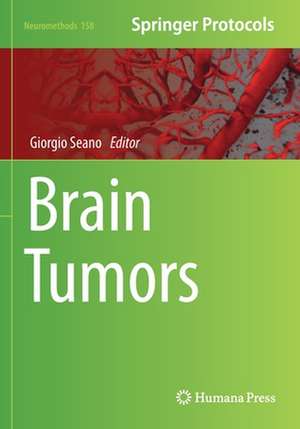 Brain Tumors de Giorgio Seano