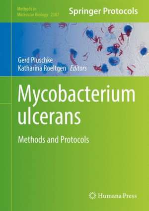 Mycobacterium ulcerans: Methods and Protocols de Gerd Pluschke