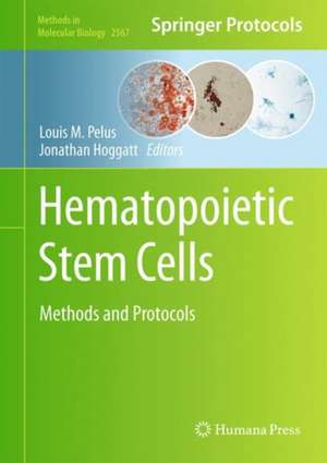 Hematopoietic Stem Cells: Methods and Protocols de Louis M. Pelus