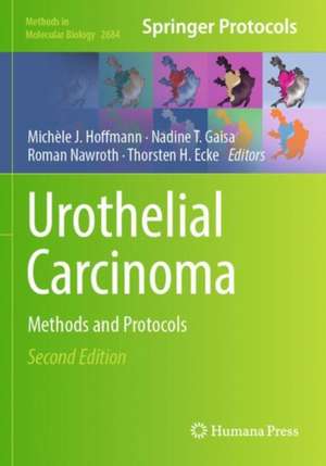 Urothelial Carcinoma: Methods and Protocols de Michèle J. Hoffmann