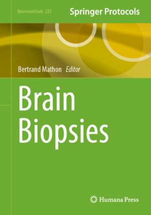 Brain Biopsies de Bertrand Mathon
