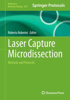 Laser Capture Microdissection de Roberta Noberini