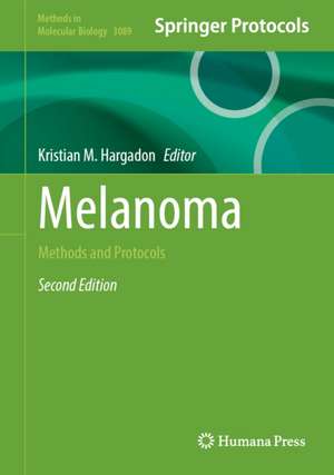 Melanoma de Kristian M Hargadon