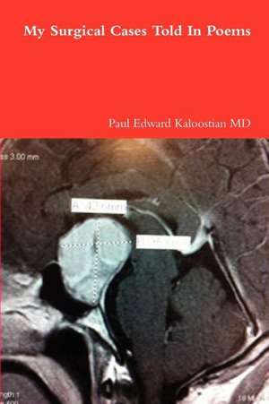 My Surgical Cases Told in Poems: The Quest for Avalon de Paul Edward Kaloostian MD