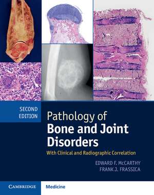 Pathology of Bone and Joint Disorders Print and Online Bundle: With Clinical and Radiographic Correlation de Edward F. McCarthy