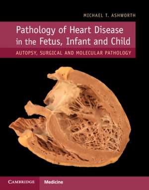 Pathology of Heart Disease in the Fetus, Infant and Child: Autopsy, Surgical and Molecular Pathology de Michael T. Ashworth