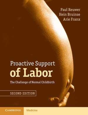 Proactive Support of Labor: The Challenge of Normal Childbirth de Paul Reuwer