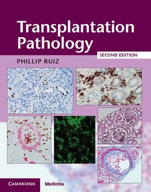 Transplantation Pathology Hardback with Online Resource de Phillip Ruiz