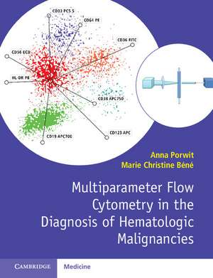 Multiparameter Flow Cytometry in the Diagnosis of Hematologic Malignancies de Anna Porwit