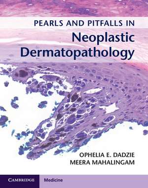 Pearls and Pitfalls in Neoplastic Dermatopathology with Online Access de Ophelia E. Dadzie