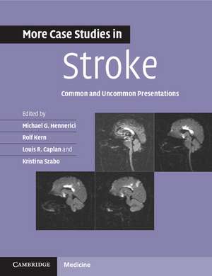 More Case Studies in Stroke: Common and Uncommon Presentations de Michael G. Hennerici