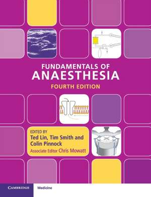 Fundamentals of Anaesthesia alte