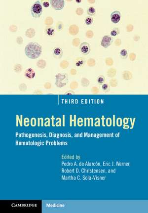 Neonatal Hematology: Pathogenesis, Diagnosis, and Management of Hematologic Problems de Pedro A. de Alarcón