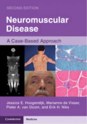 Neuromuscular Disease de Jessica E Hoogendijk