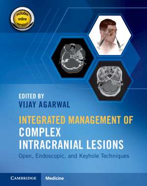 Integrated Management of Complex Intracranial Lesions Hardback Set and Static Online Product: Open, Endoscopic, and Keyhole Techniques de Vijay Agarwal