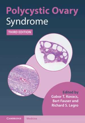 Polycystic Ovary Syndrome de Gabor T. Kovacs