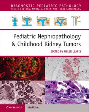 Pediatric Nephropathology & Childhood Kidney Tumors with Online Resource de Helen Liapis