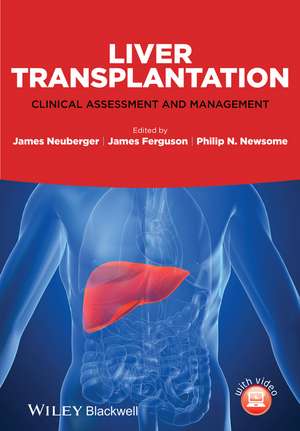 Liver Transplantation: Clinical Assessment and Management de James Neuberger