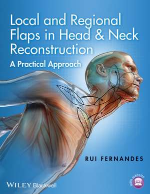 Local and Regional Flaps in Head & Neck Reconstruction – A Practical Approach de RP Fernandes