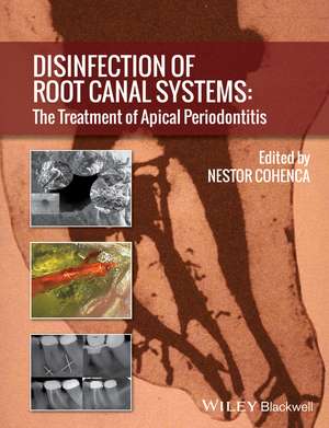 Disinfection of Root Canal Systems – The Treatment of Apical Periodontitis de N Cohenca