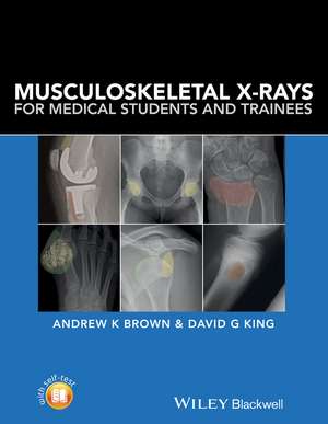 Musculoskeletal X–rays for Medical Students de AK Brown