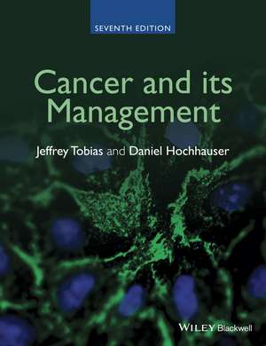 Cancer and its Management 7e de JS Tobias