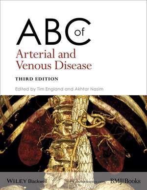 ABC of Arterial and Venous Disease 3e de T England