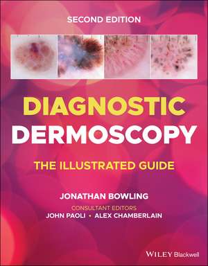 Diagnostic Dermoscopy – The Illustrated Guide, 2e de J Bowling